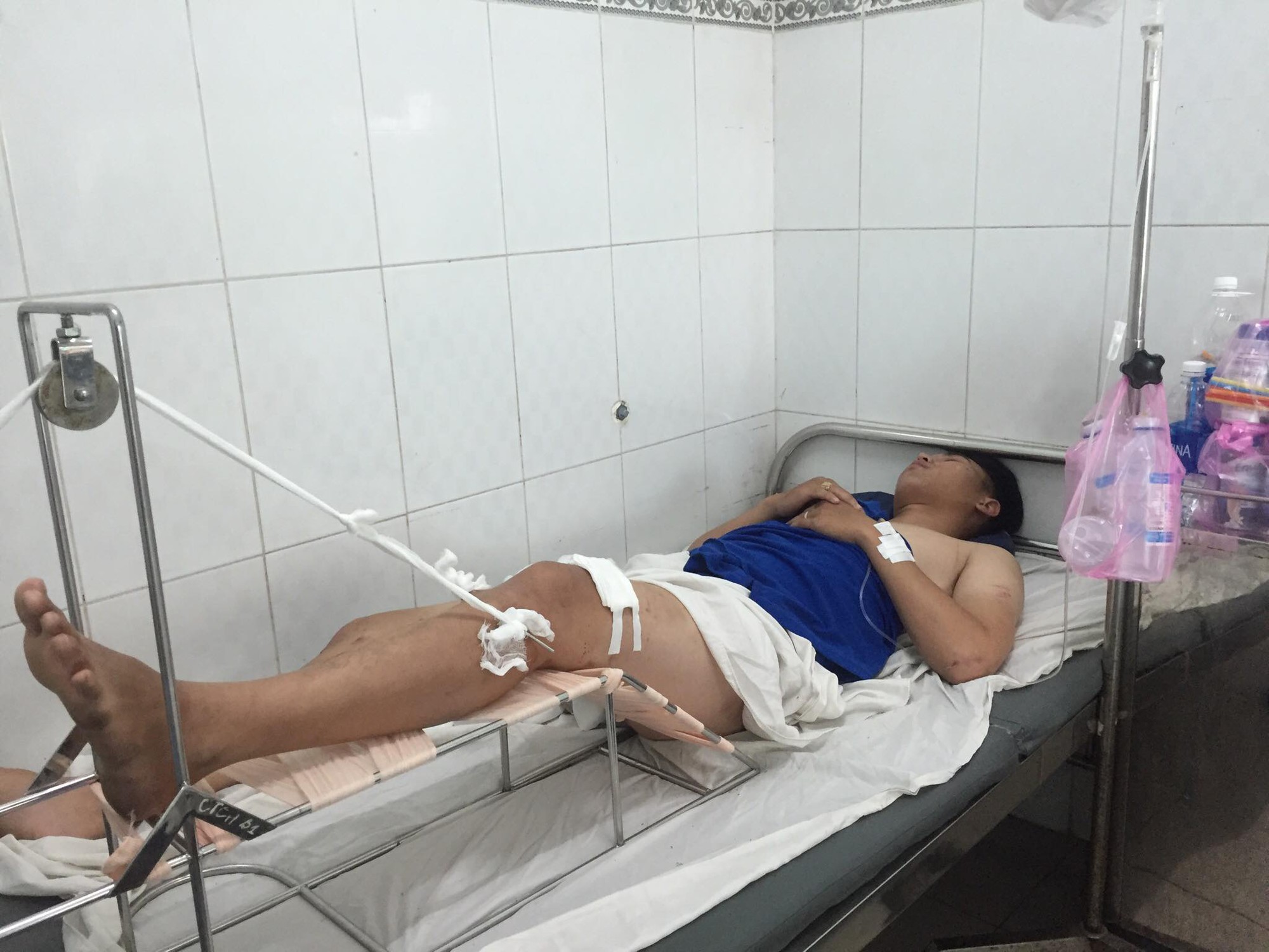 Vụ tai nạn kinh hoàng ở Sài Gòn : Thêm 1 nạn nhân nguy kịch